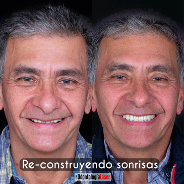 Slider image (4) Odontologia Laser